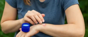 فؤائد الفكس في تهدئة لدغات الحشرات